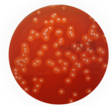 Blood Agar No2 + 5% Sheep Blood 90mm Plates