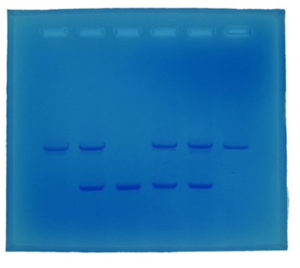 Cystic Fibrosis Testing DNA Kit